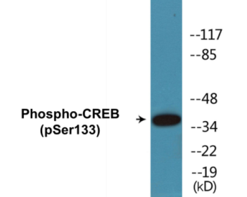 Western blot analysis of extracts from Jurkat and 293 cells treated with UV, using CREB (Phospho-Ser133) Antibody.