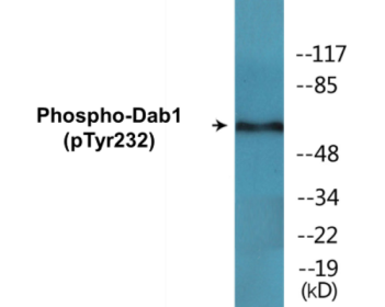 Western blot analysis of extracts from LOVO cells, using Dab1 (Phospho-Tyr232) Antibody.