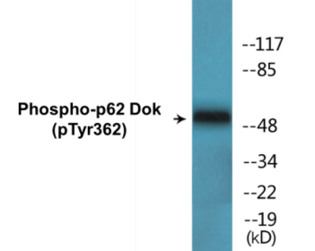 Western blot analysis of extracts from 293 cells, using p62 Dok (Phospho-Tyr362) Antibody.