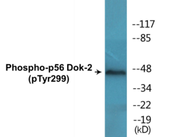 Western blot analysis of extracts from COS7 cells treated with insulin 0.01U/ml 15', Jurkat cells treated with insulin 0.01U/ml 15' and 293 cells treated with serum 20% 15', using p56 Dok-2 (Phospho-Tyr299) Antibody.