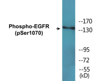Western blot analysis of extracts from SK-OV3 cells treated with EGF, using EGFR (Phospho-Ser1070) Antibody.