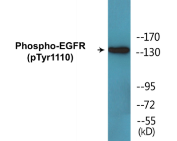Western blot analysis of extracts from HepG2 cells, using EGFR (Phospho-Tyr1110) Antibody.