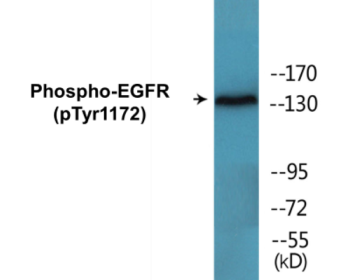 Western blot analysis of extracts from A431 cells treated with EGF 40 muM 10', using EGFR (Phospho-Tyr1172) Antibody.