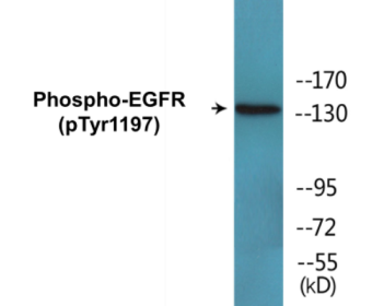 Western blot analysis of extracts from A431 cells treated with EGF 40 muM 10', using EGFR (Phospho-Tyr1197) Antibody.