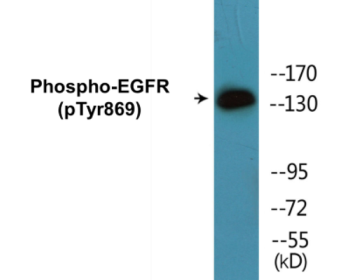 Western blot analysis of extracts from A431 cells treated with EGF 40 muM 10', using EGFR (Phospho-Tyr869) Antibody.