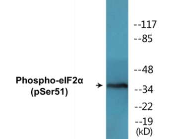 Western blot analysis of extracts from K562 cells treated with IFN-alpha 1000U/ml 18h, using eIF2 alpha (Phospho-Ser51) Antibody.