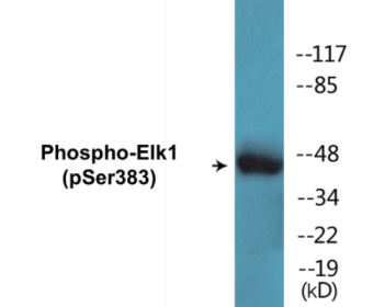 Western blot analysis of extracts from HeLa cells treated with UV, using Elk1 (Phospho-Ser383) Antibody.