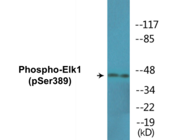 Western blot analysis of extracts from Jurkat cells treated with UV 15' and HeLa cells treated with paclitaxel 1uM 24h, using Elk1 (Phospho-Ser389) Antibody.