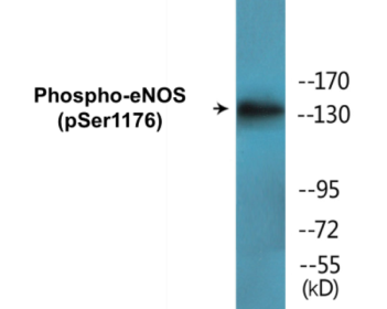 Western blot analysis of extracts from HeLa cells treated with Insulin 0.01U/ml 15', using eNOS (Phospho-Ser1176) Antibody.