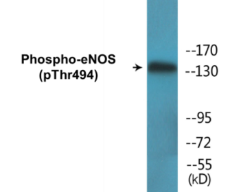 Western blot analysis of extracts from Jurkat cells, using eNOS (Phospho-Thr494) Antibody.