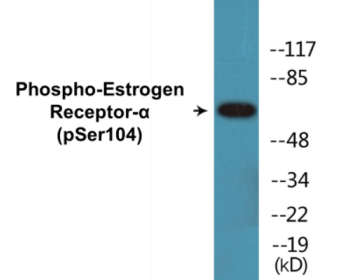 Western blot analysis of extracts from 293 cells, using Estrogen Receptor-alpha (Phospho-Ser104) Antibody.