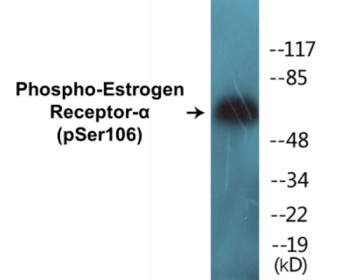 Western blot analysis of extracts from MCF7 cells, using Estrogen Receptor-alpha (Phospho-Ser106) Antibody.