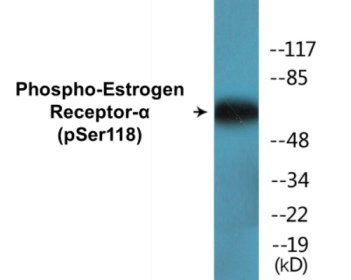 Western blot analysis of extracts from MCF7 cells treated with Estradiol, using Estrogen Receptor-alpha (Phospho-Ser118) Antibody.