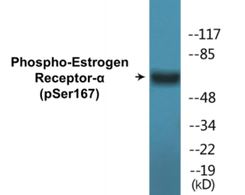 Western blot analysis of extracts from MCF7 cells treated with EGF, using Estrogen Receptor-alpha (Phospho-Ser167) Antibody.