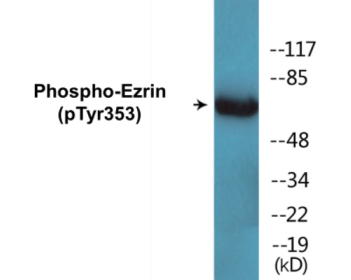 Western blot analysis of extracts from A431 cells treated with EGF 200ng/ml 30', using Ezrin (Phospho-Tyr353) Antibody.