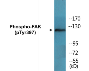 Western blot analysis of extracts from Jurkat cells treated with Ca2+ 40nM 30', using FAK (Phospho-Tyr397) Antibody.
