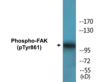 Western blot analysis of extracts from HeLa cells, Jurkat cells and COS cells, using FAK (Phospho-Tyr861) Antibody.