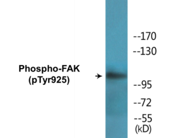 Western blot analysis of extracts from Jurkat and HepG2 cells, using FAK (Phospho-Tyr925) Antibody.