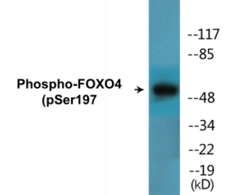 Western blot analysis of extracts from 293 cells treated with serum, using AFX (Phospho-Ser197) Antibody.