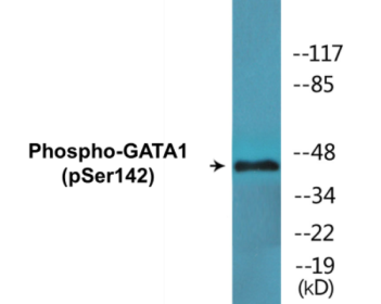 Western blot analysis of extracts from K562 cells, using GATA1 (Phospho-Ser142) Antibody.
