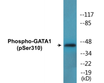 Western blot analysis of extracts from COS7 cells treated with EPO, using GATA1 (Phospho-Ser310) Antibody.