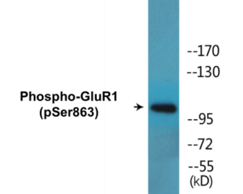Western blot analysis of extracts from MCF-7 cells, using GluR1 (Phospho-Ser863) Antibody.