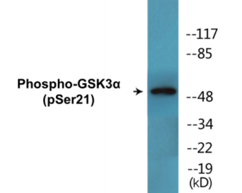Western blot analysis of extracts from ovary cancer, using GSK3 alpha (Phospho-Ser21) Antibody.