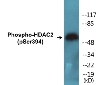 Western blot analysis of extracts from LOVO cells, using HDAC2 (Phospho-Ser394) Antibody.