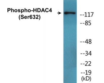Western blot analysis of extracts from 293 cells treated with etoposide 25uM 1hour and Jurkat cells treated with etoposide 25uM 24hours, using HDAC4 (Phospho-Ser632) Antibody.