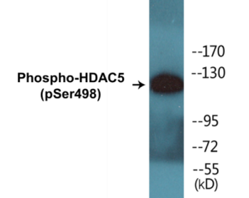 Western blot analysis of extracts from Jurkat cells, using HDAC5 (Phospho-Ser498) Antibody.