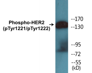 Western blot analysis of extracts from SK-OV3 cells treated with EGF, using HER2 (Phospho-Tyr1221/Tyr1222) Antibody.