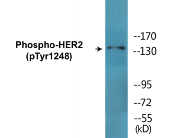 Western blot analysis of extracts from HepG2 cells treated with PMA 125ng/ml 30', using HER2 (Phospho-Tyr1248) Antibody.