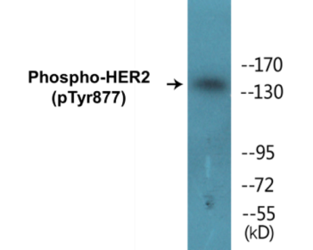 Western blot analysis of extracts from HepG2 cells and HeLa cells, using HER2 (Phospho-Tyr877) Antibody.