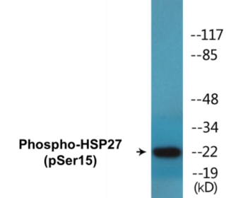 Western blot analysis of extracts from HeLa cells treated with UV, using HSP27 (Phospho-Ser15) Antibody.