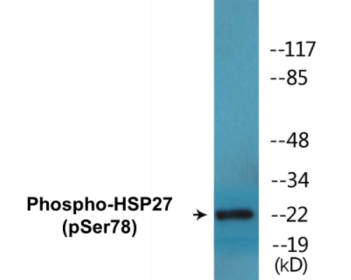 Western blot analysis of extracts from HeLa cells treated with Ca2+, using HSP27 (Phospho-Ser78) Antibody.