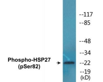 Western blot analysis of extracts from HuvEc cells treated with TNF 20ng/ml 30', using HSP27 (Phospho-Ser82) Antibody.