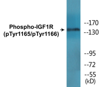 Western blot analysis of extracts from 293 cells treated with Insulin, using IGF1R (Phospho-Tyr1165/Tyr1166) Antibody.