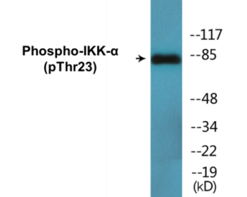 Western blot analysis of extracts from MDA-MB-435 cells treated with EGF, using IKK-alpha (Phospho-Thr23) Antibody.