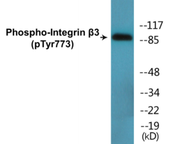 Western blot analysis of extracts from HL-60 cells treated with H2O2, using Integrin beta3 (Phospho-Tyr773) Antibody.