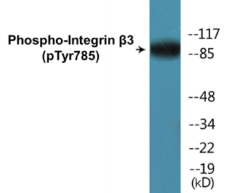 Western blot analysis of extracts from HeLa cells, HepG2 cells and HuvEc cells, using Integrin beta3 (Phospho-Tyr785) Antibody.