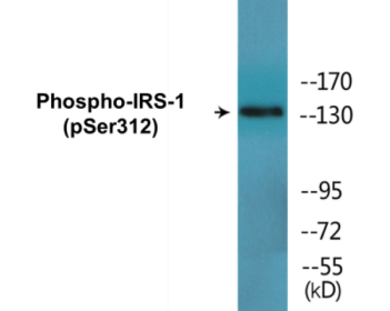 Western blot analysis of extracts from HepG2 cells, using IRS-1 (Phospho-Ser312) Antibody.