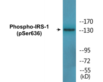 Western blot analysis of extracts from 293 cells and COLO205 cells, using IRS-1 (Phospho-Ser636) Antibody.