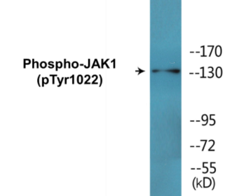 Western blot analysis of extracts from A549 cells , using JAK1 (Phospho-Tyr1022) Antibody.