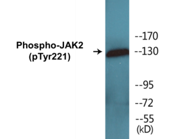 Western blot analysis of extracts from K562 cells, using JAK2 (Phospho-Tyr221) Antibody.