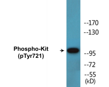 Western blot analysis of extracts from HepG2 cells treated with EGF 200ng/ml 30', using c-Kit (Phospho-Tyr721) Antibody.