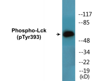 Western blot analysis of extracts from Jurkat cells, using Lck (Phospho-Tyr393) Antibody.