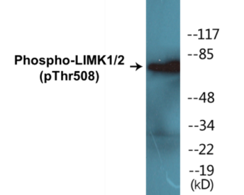 Western blot analysis of extracts from COLO205 cells, using LIMK1 (Phospho-Thr508) Antibody.