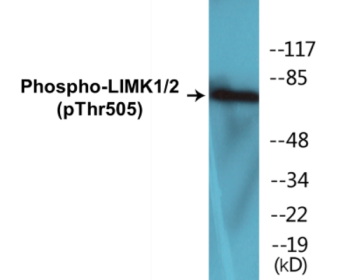 Western blot analysis of extracts from COLO205 cells, using LIMK2 (Phospho-Thr505) Antibody.
