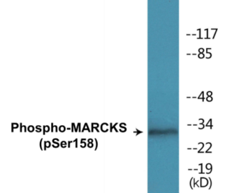 Western blot analysis of extracts from K562 cells treated with EGF 200ng/ml 30', using MARCKS (Phospho-Ser158) Antibody.