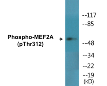Western blot analysis of extracts from NIH-3T3 cells treated with PMA, using MEF2A (Phospho-Thr312) Antibody.
